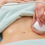 HIFU Treatment: Non-Surgical Facelift and Body Contouring