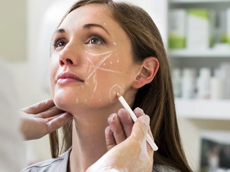 Non-Surgical Nose Job (Nose Fillers)