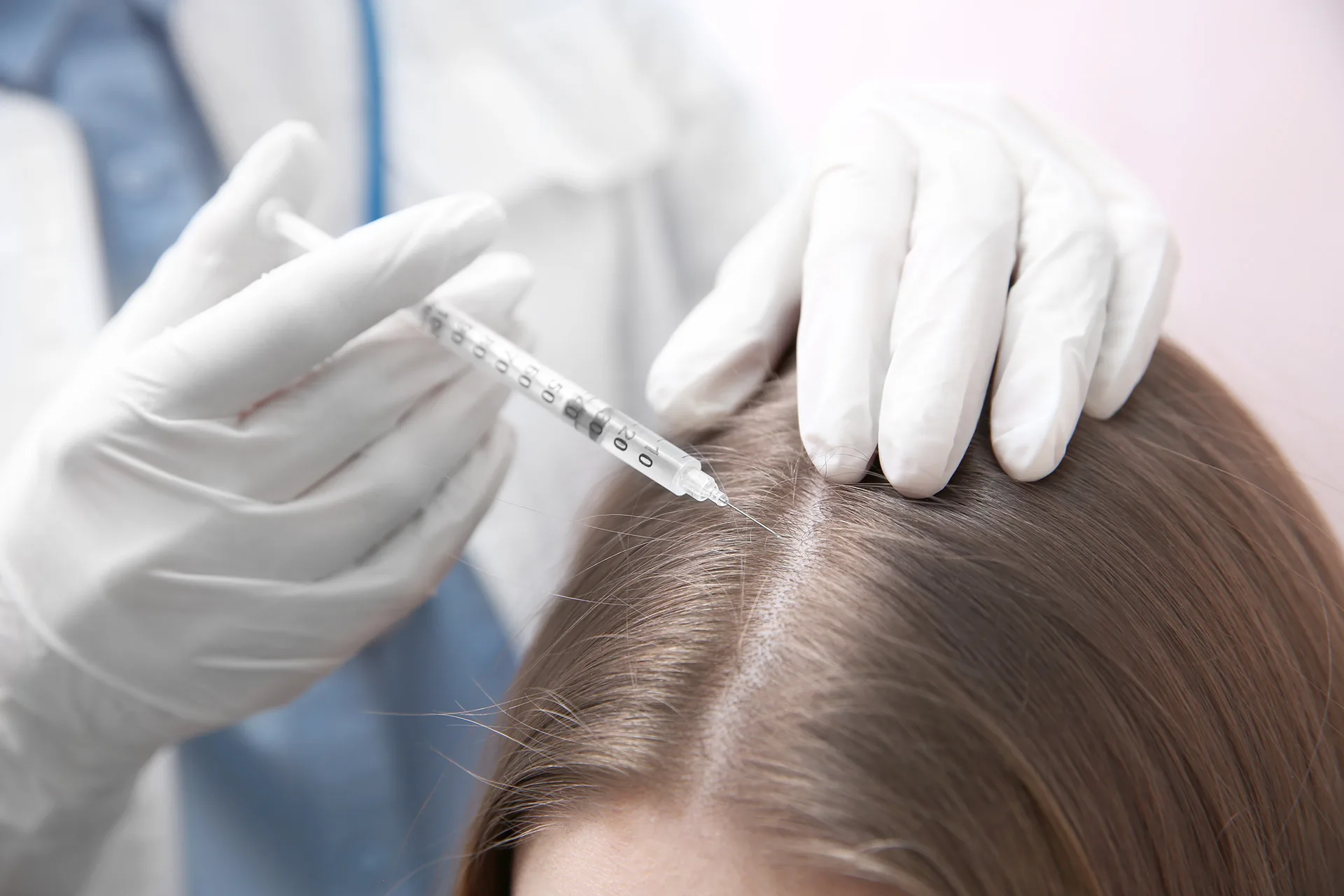 PRGF Hair Treatment