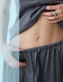 Stretch Marks Reduction