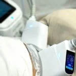 CoolSculpting