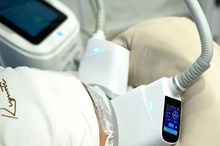 CoolSculpting fat freezing: two cooling applicators on the love handles of a patient lying on a treatment bed