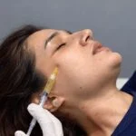 Jalupro skin booster