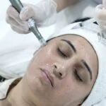 Mesotherapy for Face