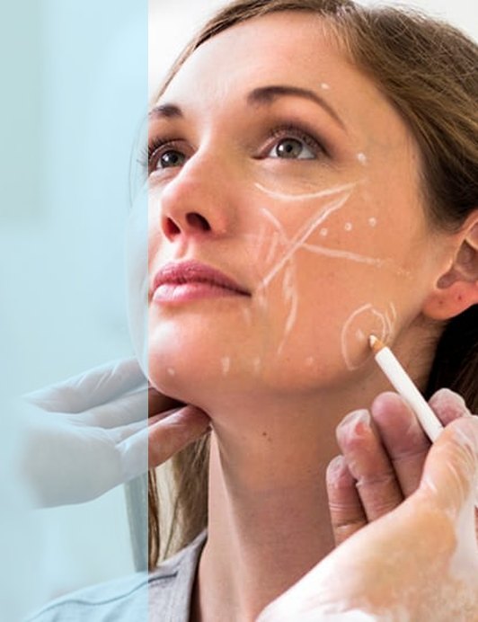 Non-Surgical Nose Job (Nose Fillers)