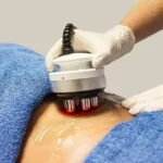 Body skin tightening