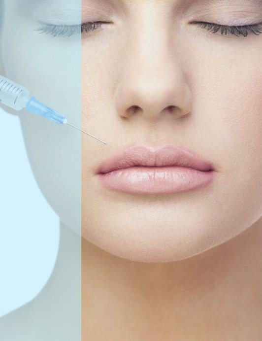 Sculptra Collagen Stimulator