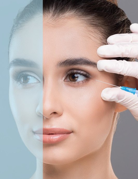 Under-Eye (Tear Trough) Fillers